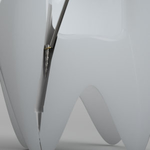 File Retrieval Accessoiries