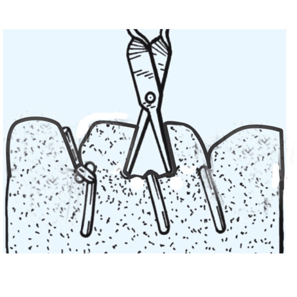 Softouch Suture Scissors - Image 2