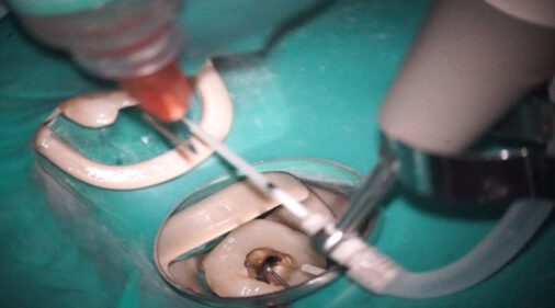 EndoColibri in action